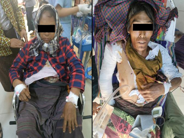 လက်နက်ကိုင်အကြမ်းဖက်သမားများက ကျေးရွာအတွင်းသို့ Drop Bomb များ၊ စိန်ပြောင်းများ၊ လက်နက်ကြီးများဖြင့် ပစ်ခတ်တိုက်ခိုက်ခဲ့မှုကြောင့် သာသနာ့အနွယ်ဝင် သံဃာတော် တစ်ပါး အပါအဝင် အပြစ်မဲ့ အရပ်သားပြည်သူများ ထိခိုက်ဒဏ်ရာရရှိ