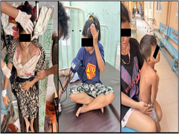 စစ်ကိုင်းတိုင်းဒေသကြီး၊ ရွှေဘိုမြို့နယ်၌ လက်နက်ကိုင်အကြမ်းဖက်သမားများက ရပ်ကွက်အတွင်းသို့ လက်နက်ကြီးများဖြင့် ပစ်ခတ်တိုက်ခိုက်ခဲ့မှုကြောင့် ကလေးငယ် တစ်ဦး အပါအဝင် အပြစ်မဲ့ အရပ်သား ပြည်သူ ငါးဦး ထိခိုက်ဒဏ်ရာရရှိ