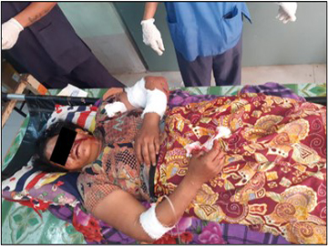 စစ်ကိုင်းတိုင်းဒေသကြီး၊ ရွှေဘိုမြို့နယ်၌ PDF အမည်ခံ အကြမ်းဖက်အဖွဲ့က ထောင်ထားသည့် မိုင်းပေါက်ကွဲမှုကြောင့် အပြစ်မဲ့ပြည်သူ တစ်ဦး ထိခိုက်ဒဏ်ရာရရှိ