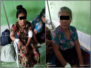 ပဲခူးတိုင်းဒေသကြီး၊ ဝေါမြို့နယ်၌ KNU အဖွဲ့မှ အကြမ်းဖက်မှုကို လိုလားသူများနှင့် PDF အမည်ခံ အကြမ်းဖက်သမားများပူးပေါင်းအဖွဲ့က ကျေးရွာအတွင်းသို့ Drone ဖြင့် Drop Bomb များ ပစ်ချ တိုက်ခိုက်ခဲ့မှုကြောင့် အပြစ်မဲ့ အရပ်သားပြည်သူ တစ်ဦး သေဆုံးကာ နှစ်ဦး ထိခိုက်ဒဏ်ရာ