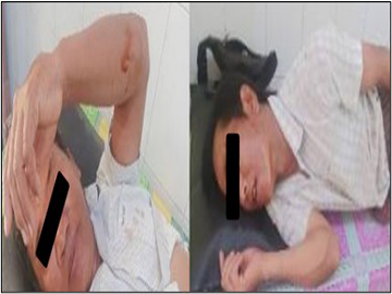 ပဲခူးတိုင်းဒေသကြီး၊ ကျောက်တံခါးမြို့နယ်၌ KNU အဖွဲ့မှ အကြမ်းဖက်မှုကို လိုလားသူများနှင့် PDF အမည်ခံ အကြမ်းဖက်သမားများ ပူးပေါင်းအဖွဲ့ ထောင်ထားသည့် မိုင်း တစ်လုံး ပေါက်ကွဲ ခဲ့မှုကြောင့် အပြစ်မဲ့ အရပ်သားပြည်သူ နှစ်ဦး ထိခိုက်ဒဏ်ရာရရှိ