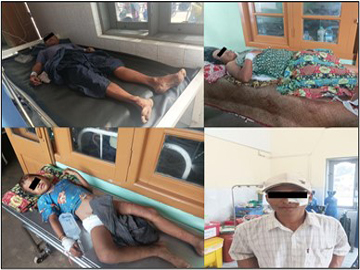 ပဲခူးတိုင်းဒေသကြီး၊ ထန်းတပင်မြို့နယ်၌ PDF အမည်ခံ အကြမ်းဖက်အဖွဲ့က ကျေးရွာအတွင်းသို့ လက်နက်ကြီးဖြင့် ပစ်ခတ်တိုက်ခိုက်ခဲ့မှုကြောင့် ကလေးငယ် တစ်ဦး အပါအဝင် အပြစ်မဲ့ အရပ်သားပြည်သူ လေးဦး ထိခိုက်ဒဏ်ရာရရှိ