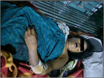 မန္တလေးတိုင်းဒေသကြီး၊ မြင်းခြံမြို့နယ်၌ PDF အမည်ခံ အကြမ်းဖက်အဖွဲ့က ကျေးရွာအတွင်းသို့ လက်နက်ကြီးဖြင့် ပစ်ခတ်တိုက်ခိုက်ခဲ့မှုကြောင့် အပြစ်မဲ့ အရပ်သားပြည်သူ တစ်ဦး သေဆုံးကာ လေးဦး ထိခိုက်ဒဏ်ရာရရှိ