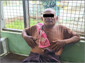 ပဲခူးတိုင်းဒေသကြီး၊ ဝေါမြို့နယ်၌ KNU အဖွဲ့မှ အကြမ်းဖက်မှုကို လိုလားသူများနှင့် PDF အမည်ခံ အကြမ်းဖက်သမားများ ပူးပေါင်းအဖွဲ့က လုပ်ကြံသတ်ဖြတ်မှုကြောင့် အပြစ်မဲ့ အရပ်သားပြည်သူ တစ်ဦး ထိခိုက်ဒဏ်ရာရရှိ