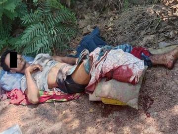 ပဲခူးတိုင်းဒေသကြီး၊ လက်ပံတန်းမြို့နယ်၌ PDF အမည်ခံ အကြမ်းဖက်အဖွဲ့ထောင်ထားသည့် မိုင်း တစ်လုံး ပေါက်ကွဲခဲ့မှုကြောင့် အပြစ်မဲ့ အရပ်သားပြည်သူ တစ်ဦး ထိခိုက်ဒဏ်ရာရရှိ