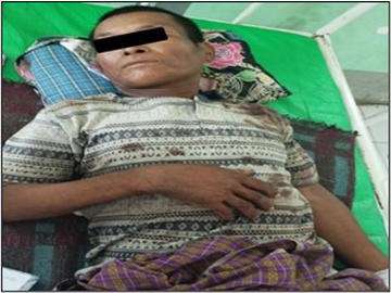 မကွေးတိုင်းဒေသကြီး၊ ပွင့်ဖြူမြို့နယ်၌ PDF အမည်ခံ အကြမ်းဖက်အဖွဲ့က ထောင်ထားသည့် လက်လုပ်မိုင်း တစ်လုံး ပေါက်ကွဲခဲ့မှုကြောင့် အပြစ်မဲ့ အရပ်သားပြည်သူ နှစ်ဦး ထိခိုက်ဒဏ်ရာရရှိ