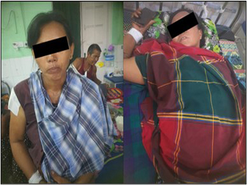 စစ်ကိုင်းတိုင်းဒေသကြီး၊ အရာတော်မြို့နယ်၌ အကြမ်းဖက်အဖွဲ့(စိစစ်ဆဲ)က ကျေးရွာအတွင်းသို့ လက်နက်ကြီးဖြင့် ပစ်ခတ်တိုက်ခိုက်ခဲ့မှုကြောင့် အပြစ်မဲ့ အရပ်သားပြည်သူ နှစ်ဦး ထိခိုက်ဒဏ်ရာရရှိ