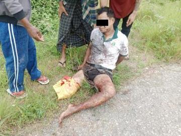 ကယားပြည်နယ်၊ လွိုင်ကော်မြို့နယ်၌ အကြမ်းဖက်အဖွဲ့(စိစစ်ဆဲ) ထောင်ထားသည့် နင်းမိုင်း တစ်လုံးအား နင်းမိပေါက်ကွဲခဲ့မှုကြောင့် အပြစ်မဲ့ အရပ်သားပြည်သူ တစ်ဦး ထိခိုက်ဒဏ်ရာရရှိ